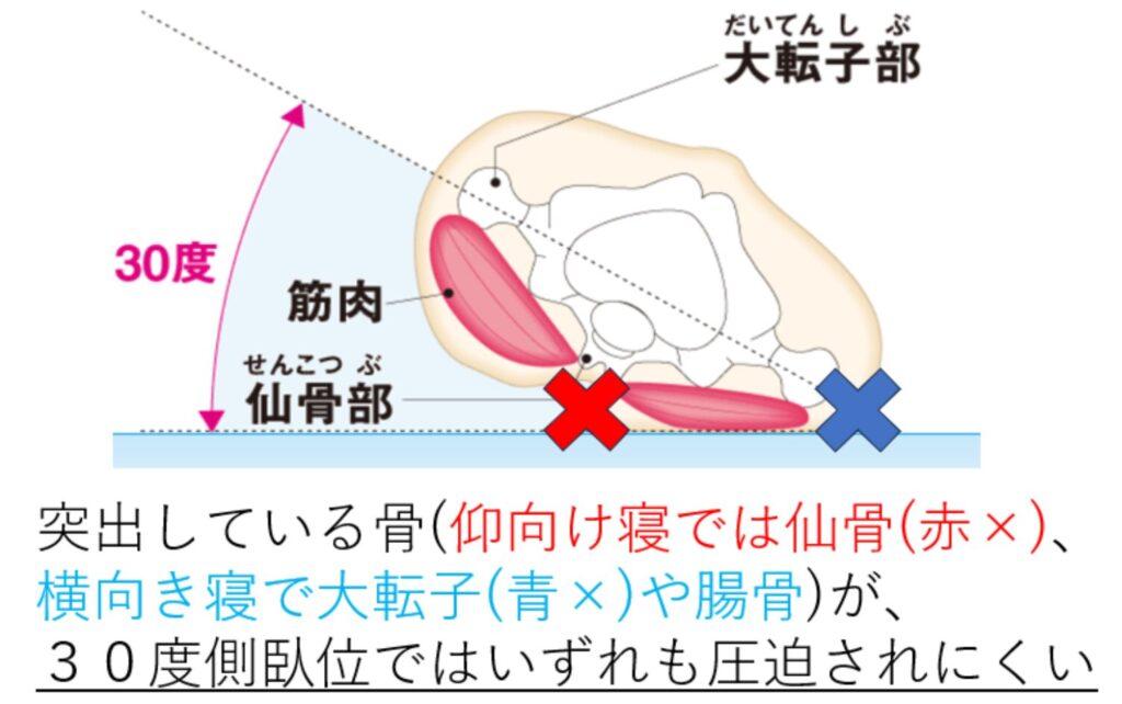 授乳期の圧迫回避と胸部・肩周りケア徹底解説