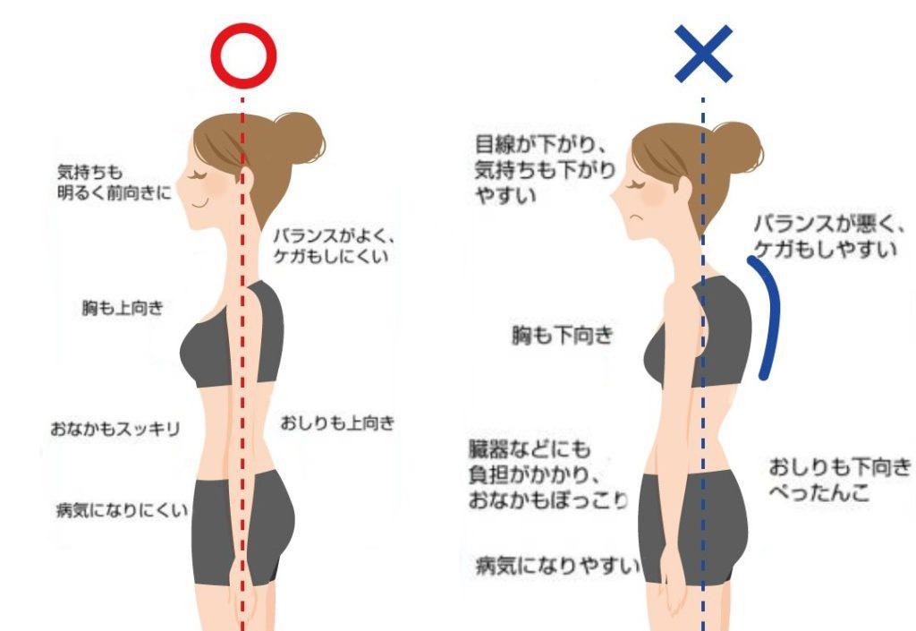 姿勢改善プログラムの失敗例